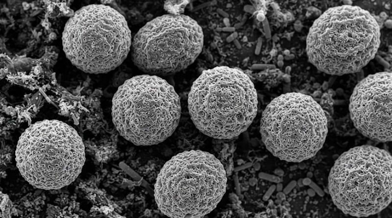 FDA RETROCEDE EN CASO DE CYCLOSPORA EN LECHUGA; INVESTIGACIÓN SIGUE