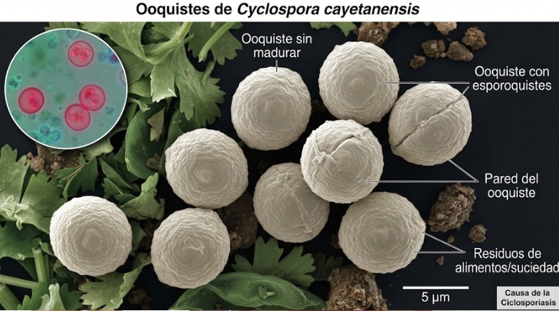 CICLOSPORIASIS PONE AL DESCUBIERTO FALLAS EN RASTREO DE ALIMENTOS EN EU