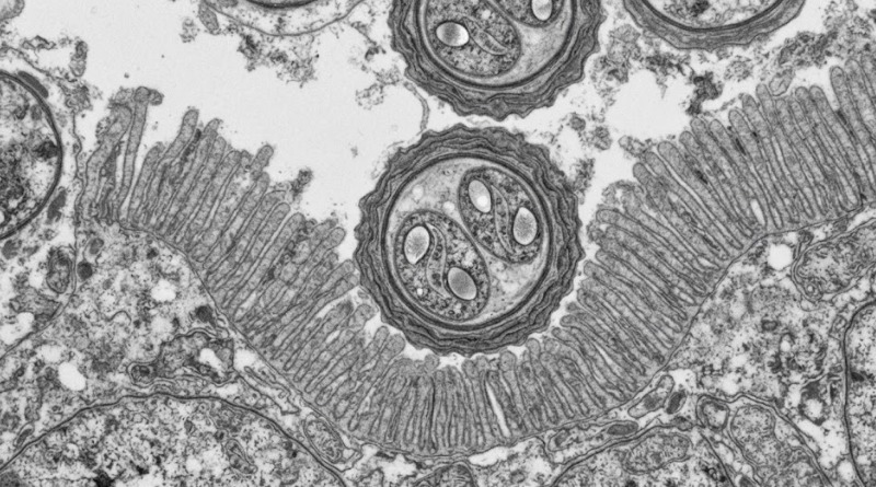LA CICLOSPORIASIS EXPLICADA: ORIGEN Y VÍAS DE TRANSMISIÓN